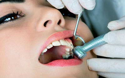 Лечение  кариеса зубов